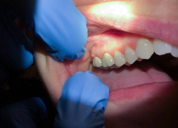 Best Broken or Cracked Tooth Emergency Dentist in Colton, CA